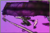 Einzelne Fragmente von mineralisierten Holzzellen, in der oberen Bildhlfte liegen zwei Gefsse von Erle, mit leiterfrmigen Durchbrechungen  